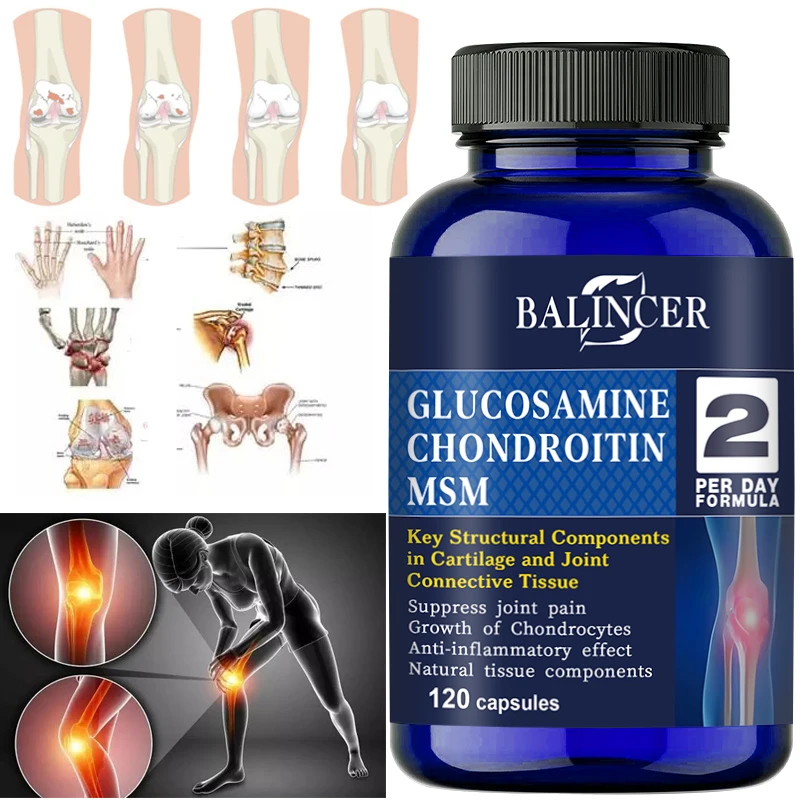 Glucosamin-Condroitin-MSM-Kapseln, für die Gelenkgesundheit, fördern die Mobilität von Knochen und Gelenken, Nahrungsergänzungsmittel